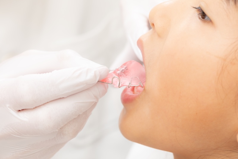 当院の矯正治療診療方針