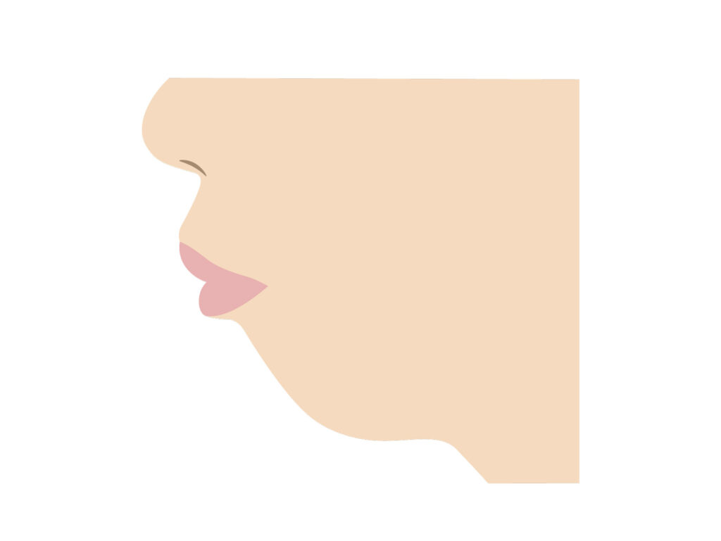 口元が突き出している（口ゴボ）とは？