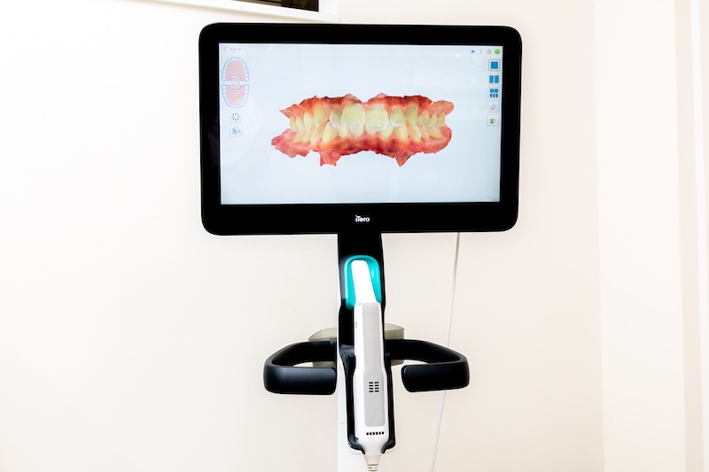 iTeroLUMINA（アイテロルミナ）を導入